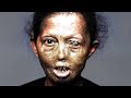 Napalm in Warfare and Culture