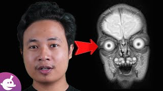Alat Medis Paling Keren yang Bisa Menyelamatkanmu | Cara Kerja Magnetic Resonance Imaging MRI