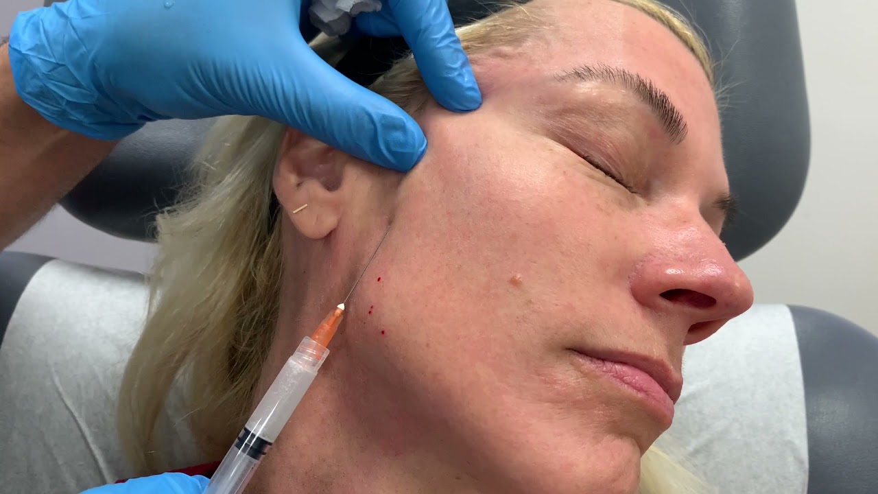 Patient receiving facial treatment in clinic setting.
