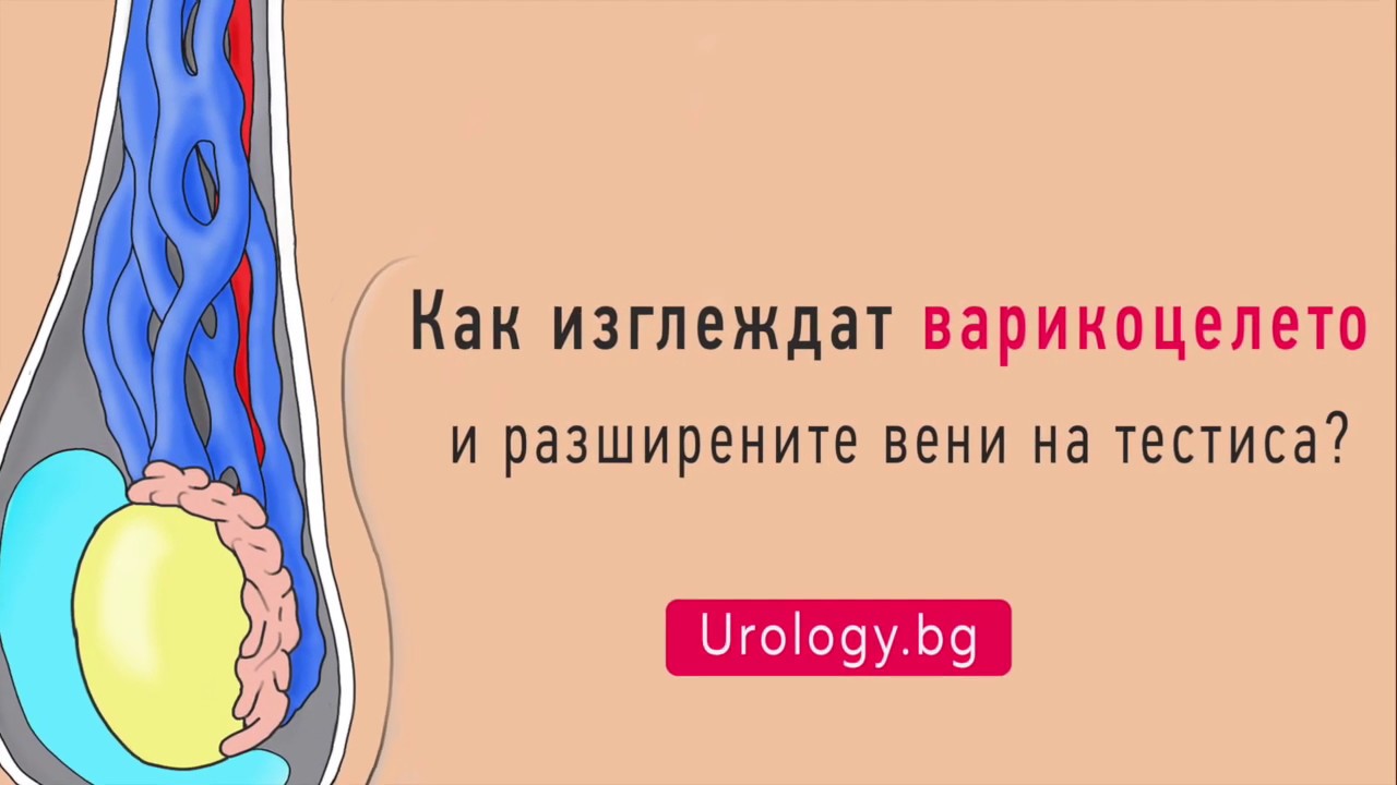 simtoma varicosera i tratamentul)