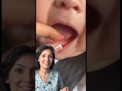 que tiene en la boca??? #dentista #dientedeleche #odontologia #odonto