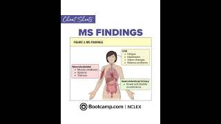 🧠 Multiple Sclerosis (MS) Findings for NCLEX | NCLEX Bootcamp Cheat Sheet