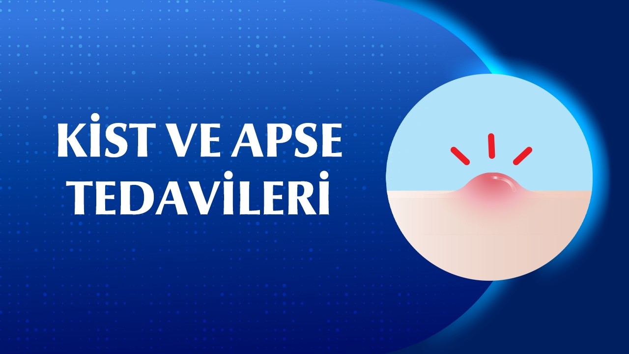 Kist ve Apse Ameliyatsız Nasıl Tedavi Edilir?