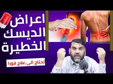 احذر هذه الأعراض الخطيرة للانزلاق الغضروفي ⚠️ العلاج قبل فوات الأوان!"