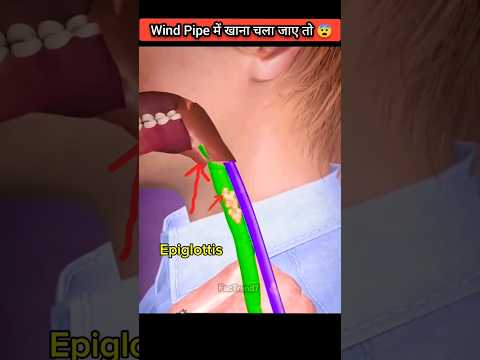 What Happen When food Enter into Wind Pipe ?? #respect #shorts #fact #viral