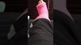 Foot Surgery Recovery Update Part 7