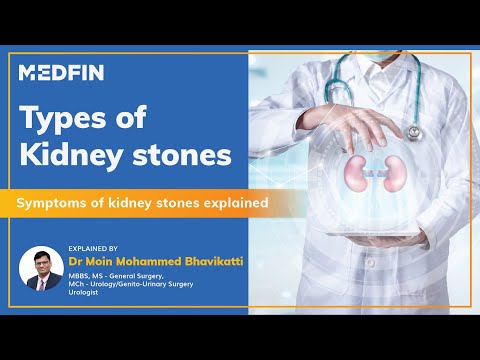 Types of kidney stones | Symptoms