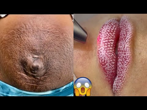 Most Extreme Beauty Treatments 2024 Best Smart and Helpful Beauty Hacks | Virtual Beauty