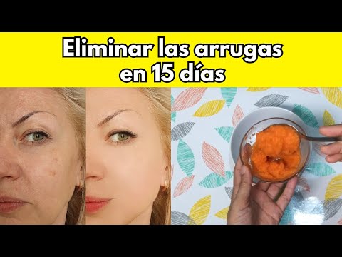 Eliminar Arrugas y Manchas  PIEL 20 AÑOS más JOVEN efecto LIFTING CASERO!! E