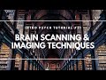 Brain Imaging Techniques and Functions