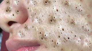 حلول طبيعية لبشرة صافية#𝐋𝐍𝐆