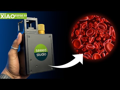 This IOT Device can help you see your Blood Cells 🔥🔥 | XIAO ESP32 S3 Sense | OpenUC2