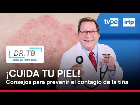 Tiña: La infección cutánea que afecta a la piel