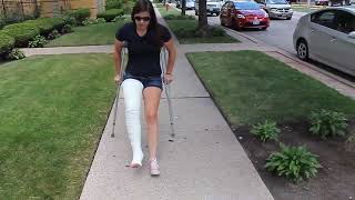   Crutches and long leg cast!