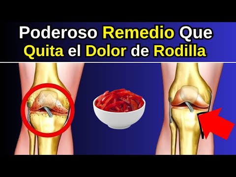 Cómo Aliviar el Dolor Articular y de Rodillas de Forma Natural