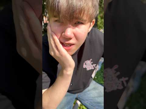 Когда у тебя заболел зуб😱😆#shorts