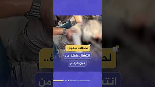 انتشال طفلة من تحت الأنقاض جراء قصف إسرائيلي على مخيم الشاطئ غربي مدينة غزة