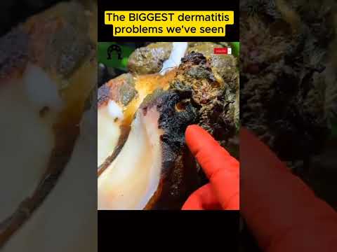 The BIGGEST dermatitis problem we’ve seen #tiktok #fyp #viral #cow #hoof #hoofcare #hoofpicking
