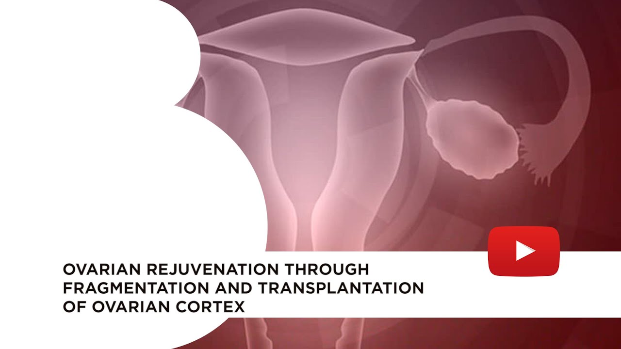 Ovarian rejuvenation through fragmentation and transplantation of ovarian cortex