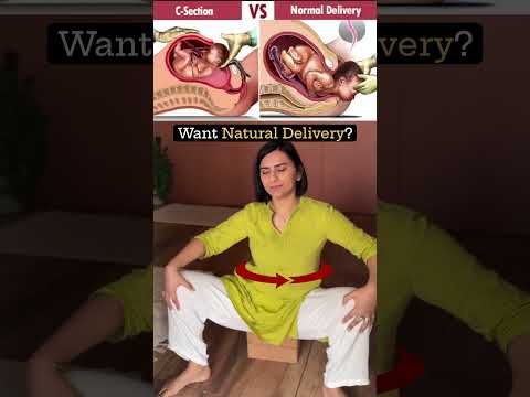 A regular Yog abhyas during pregnancy can contribute to a  higher chances of natural delivery 🌸❤️🤰🏼