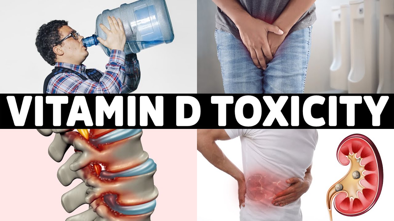 #1 Sign That You Overdosed on Vitamin D￼