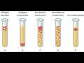 Bacterial Classification and Oxygen Requirements