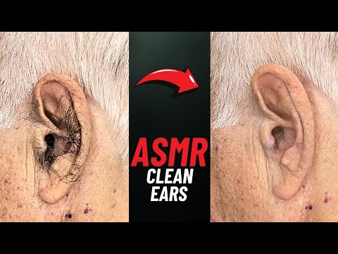 Ear cleaning ASMR with Clippers, NOT TALKING