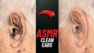 Ear cleaning ASMR with Clippers, NOT TALKING
