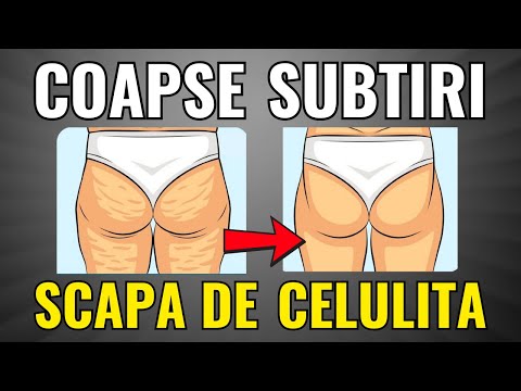 Coapse Subtiri / Scapa De CELULITA - exercitii pentru coapse acasa