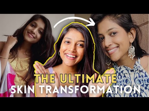 My Real SKINCARE Journey ✨Mistakes I Made & What TRANSFORMED My Skin 🩷