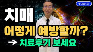 치매 치료후기[2탄] "치매예방, 골든타임 있다? 없다?" 치매검사에서 높은 수치 나온 여성의 치료사례. 알츠하이머 초기 증상, 뇌MRI에 흰점 '백질변성' 발견된 분들 필수시청