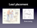 Patient Care Insights for EKG Technicians