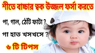 শীতে বাচ্চার ত্বকের যত্ন।। শীতকালে বাচ্চার যত্ন কিভাবে রাখবেন।।পা ফাটা।ঠোঁট ফাটা।baby care in winter