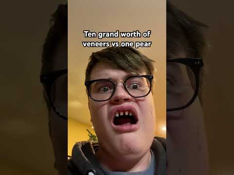 I need to go back to the dentist #veneers #dentalwork