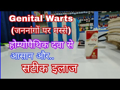 प्राइवेट पार्ट पर मस्से का इलाज, best Homeopathic medicine for genital warts, repl 172 genital warts
