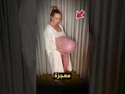 هذة المرأة معجزة حقا وحملها غريب جدا!😱🥺