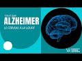 Alzheimer's Disease Concepts and Challenges