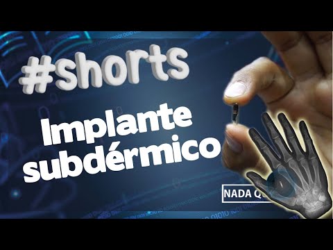 #shorts #implante #implantesubdermico #nfc #rfid #nfcimplant #rfidimplant #cyborg #5g #NadaQueHacer