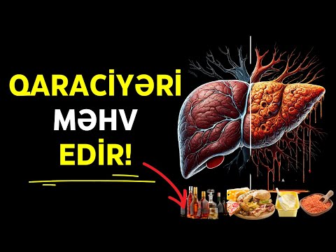 Qaraciyər Düşmənləri: Bu Qidaları Yeməkdən Dərhal İmtina Edin!