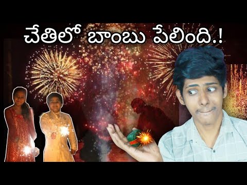 bomb blasted in my hand ? (story time ) - telugu