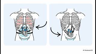 CUIDANDO LOS PULMONES: Función Pulmonar a un Año del Implante de LVAD | SciSumm Medicina