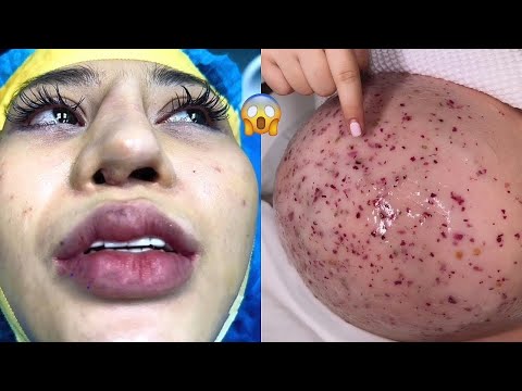 Most Extreme Beauty Treatments 2025 Best Smart and Helpful Beauty Hacks | Virtual Beauty
