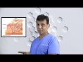 Pressure Ulcer Staging and Characteristics