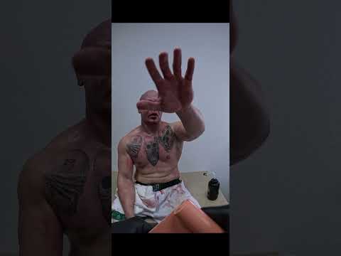 Bare-Knuckle-Kämpfer muss ins Krankenhaus
