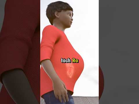 Tìm thấy xương tóc trong bụng 😨#shortvideo