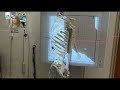 Focal Spot Blur and X-ray Techniques