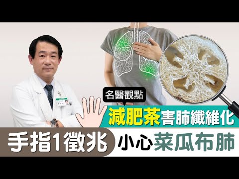 【名醫觀點】減肥茶竟喝出肺纖維化！警訊：看手指「1徵兆」小心菜瓜布肺上身