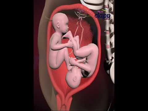 Twins struggles inside the Womb for supremacy (3D Animation)