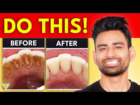 How to Remove Dental Plaque & Prevent Cavities?