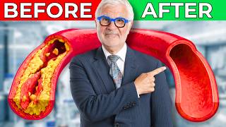 Unclog Your Arteries Naturally With These 5 Foods Recommended By A Heart Surgeon
